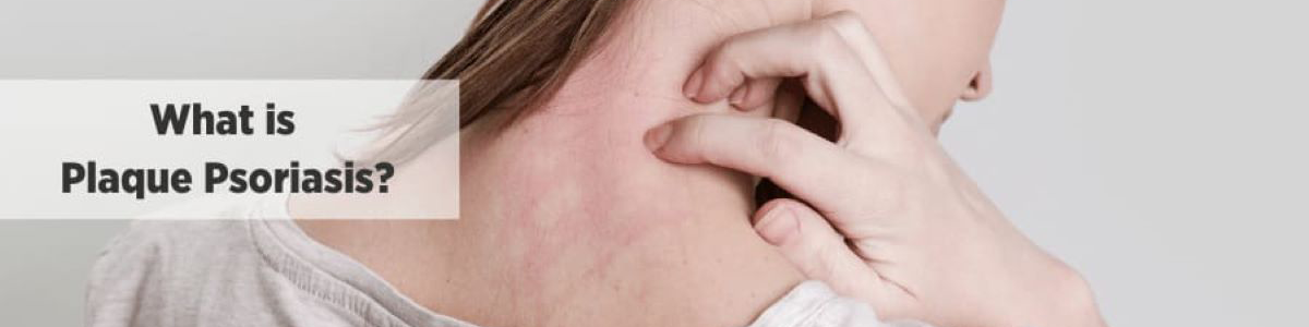 Plaque Psoriasis Definition Symptoms Causes Diagnosis Treatment Mediciations Diet Lifestyle Management